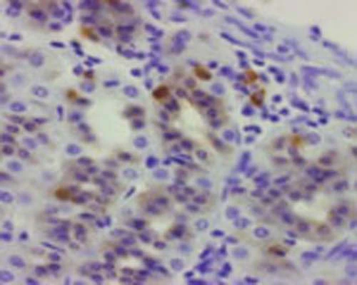 Anti-Ghrelin Antibody
