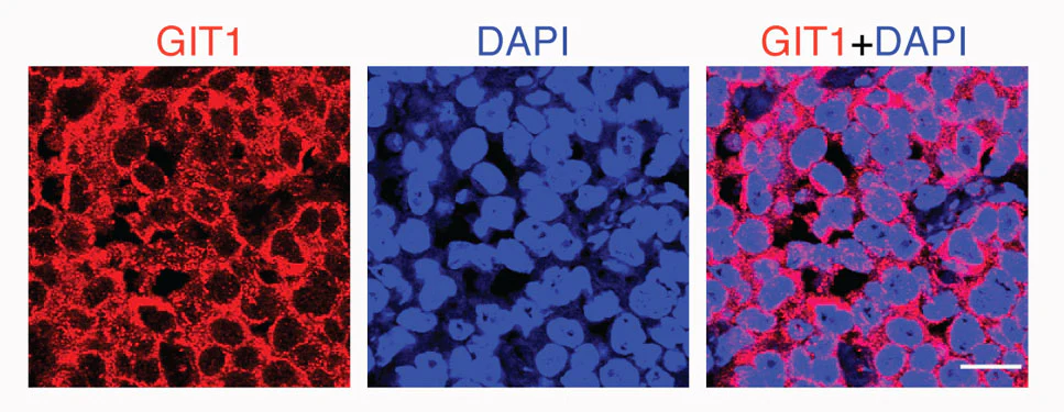Anti-GIT1 Antibody