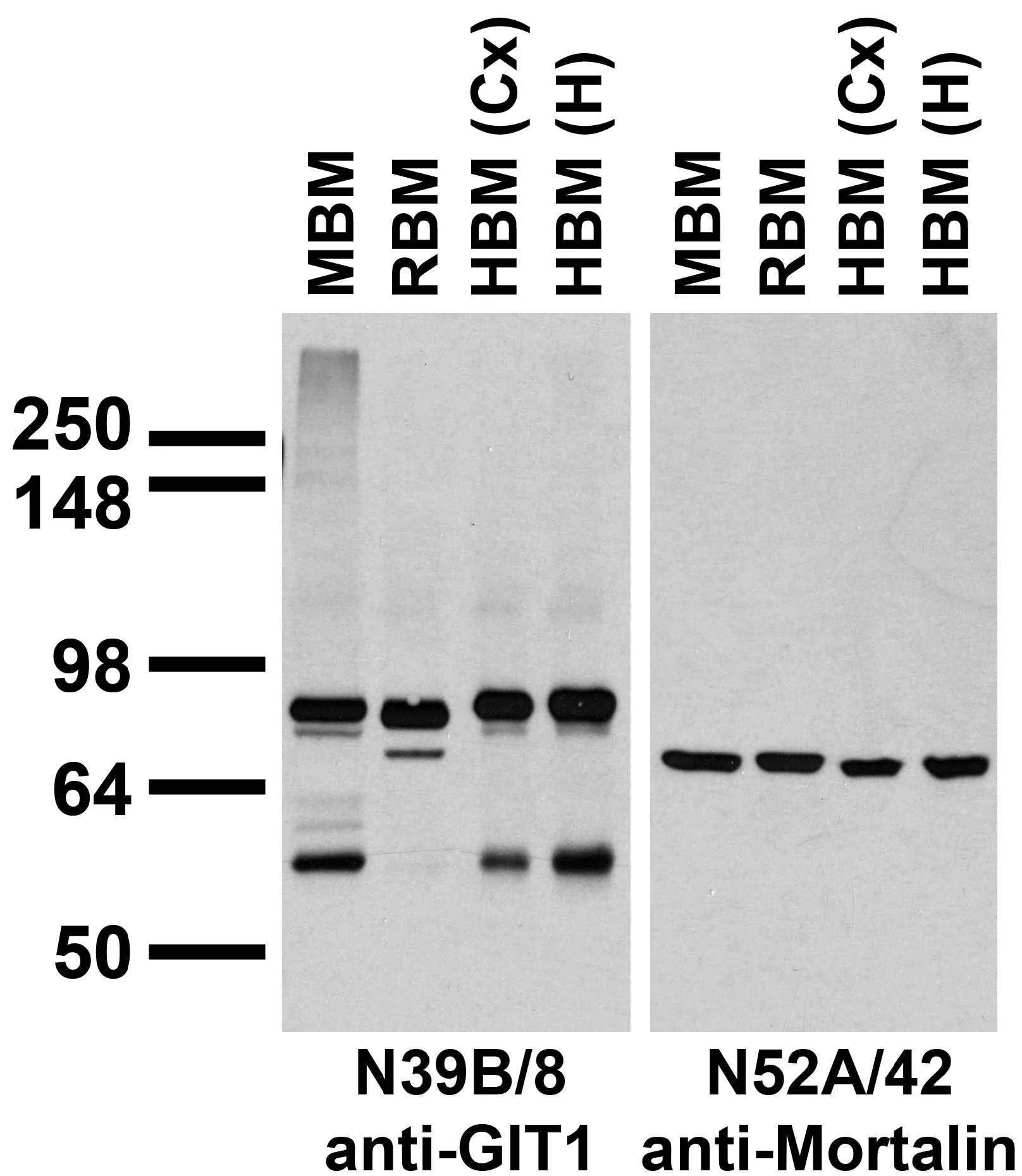 Anti-GIT1 Antibody - Image 5