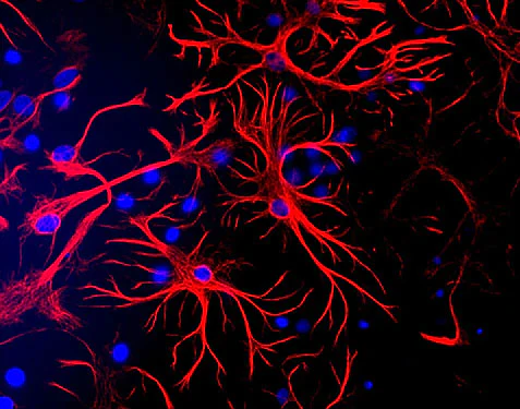Anti-Glial Fibrillary Acidic Protein (GFAP) Antibody
