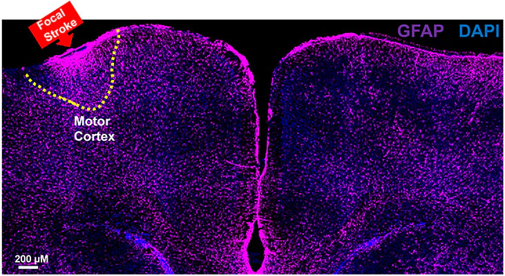 Anti-Glial Fibrillary Acidic Protein (GFAP) Antibody - Image 10