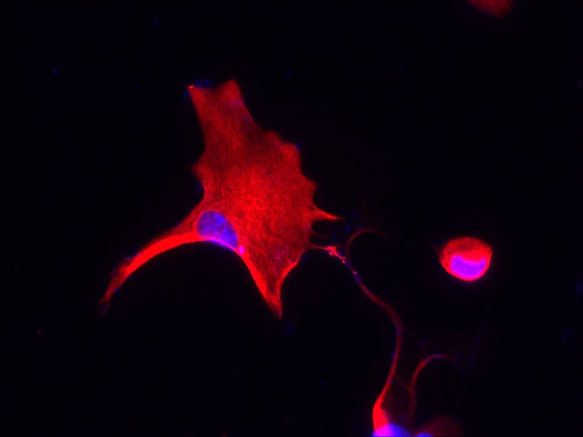 Anti-Glial Fibrillary Acidic Protein (GFAP) Antibody - Image 11