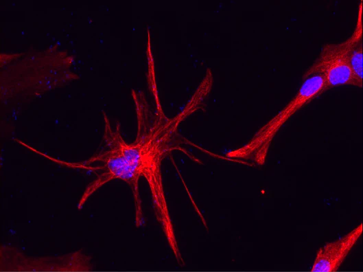Anti-Glial Fibrillary Acidic Protein (GFAP) Antibody - Image 12
