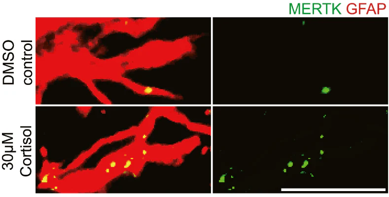 Anti-Glial Fibrillary Acidic Protein (GFAP) Antibody - Image 13