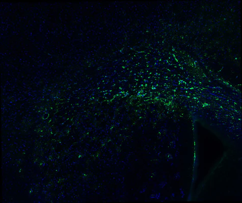 Anti-Glial Fibrillary Acidic Protein (GFAP) Antibody - Image 14