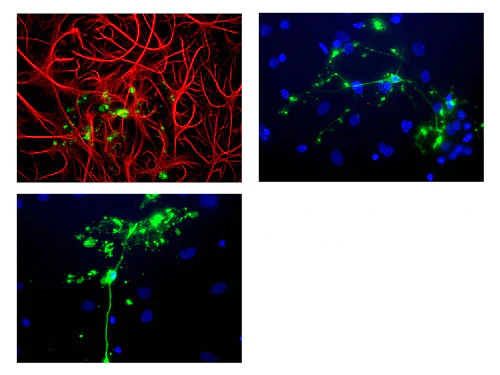 Anti-Glial Fibrillary Acidic Protein (GFAP) Antibody - Image 4