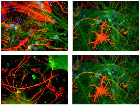 Anti-Glial Fibrillary Acidic Protein (GFAP) Antibody - Image 5