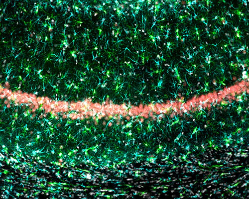 Anti-Glial Fibrillary Acidic Protein (GFAP) Antibody - Image 6