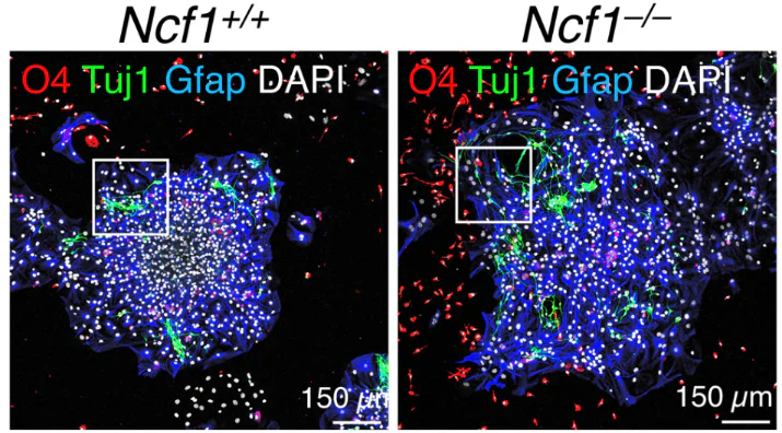 Anti-Glial Fibrillary Acidic Protein (GFAP) Antibody - Image 7
