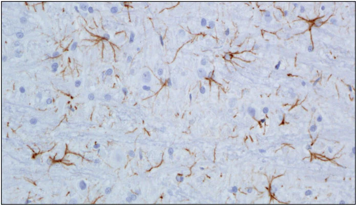 Anti-Glial Fibrillary Acidic Protein (GFAP) Antibody - Image 9
