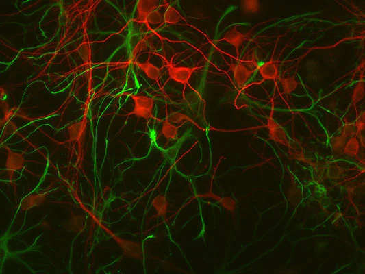 Anti-Glial Fibrillary Acidic Protein (GFAP) Antibody