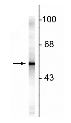 Anti-Glial Fibrillary Acidic Protein (GFAP) Antibody - Image 2