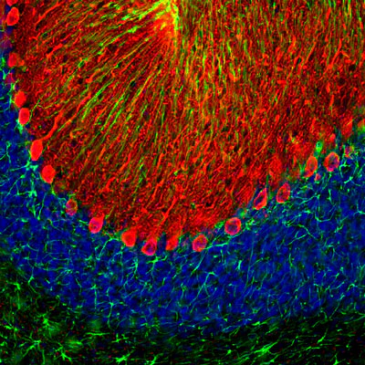 Anti-Glial Fibrillary Acidic Protein (GFAP) Antibody - Image 4