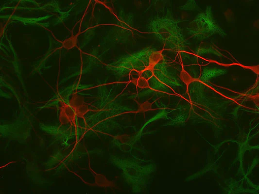 Anti-Glial Fibrillary Acidic Protein (GFAP) Antibody - Image 5