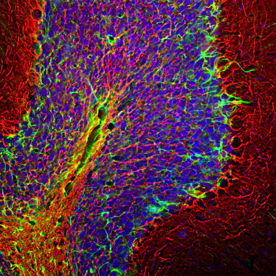 Anti-Glial Fibrillary Acidic Protein (GFAP) Antibody - Image 6