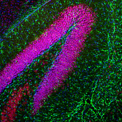 Anti-Glial Fibrillary Acidic Protein (GFAP) Antibody