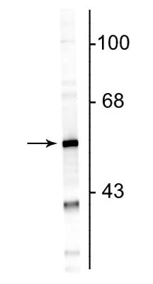Anti-Glial Fibrillary Acidic Protein (GFAP) Antibody - Image 2
