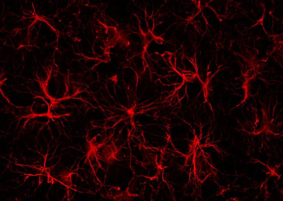 Anti-Glial Fibrillary Acidic Protein (GFAP) Antibody - Image 3