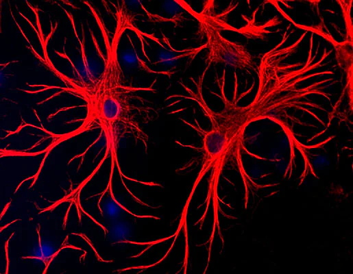 Anti-Glial Fibrillary Acidic Protein (GFAP) Antibody - Image 4