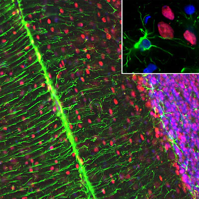 Anti-Glial Fibrillary Acidic Protein (GFAP) Antibody - Image 6