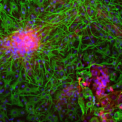 Anti-Glial Fibrillary Acidic Protein (GFAP) Antibody - Image 8