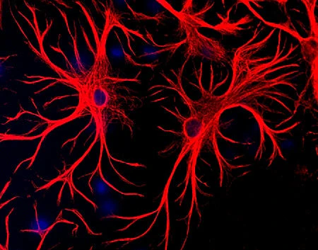Anti-Glial fibrillary acidic protein (GFAP) Antibody