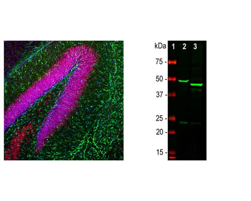 Anti-Glial fibrillary acidic protein (GFAP) Antibody - Image 2