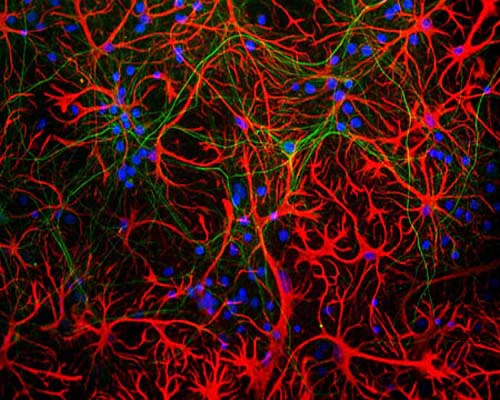 Anti-Glial fibrillary acidic protein (GFAP) Antibody