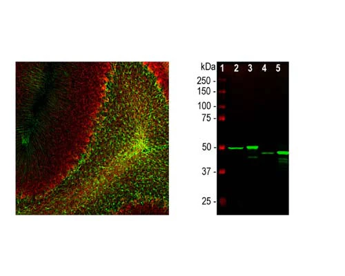 Anti-Glial fibrillary acidic protein (GFAP) Antibody - Image 2