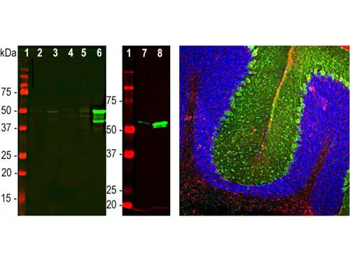 Anti-Glial Fibrillary Acidic Protein (GFAP) Antibody