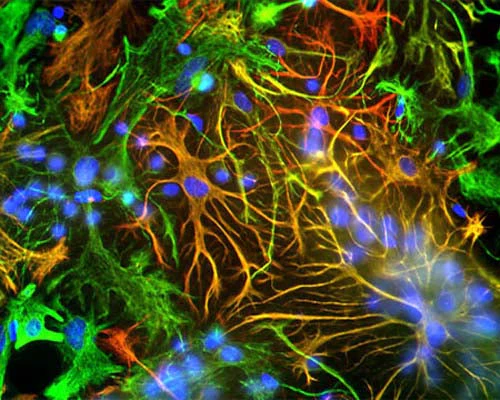 Anti-Glial Fibrillary Acidic Protein (GFAP) Antibody