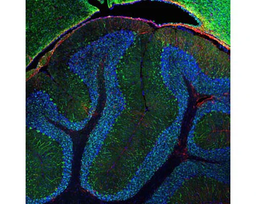 Anti-Glial Fibrillary Acidic Protein (GFAP) Antibody - Image 2