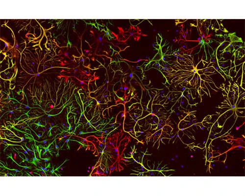 Anti-Glial Fibrillary Acidic Protein (GFAP) Antibody - Image 3
