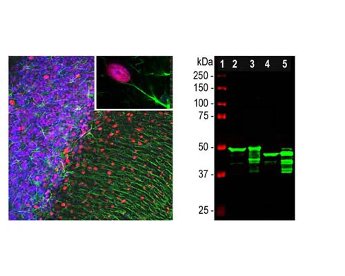 Anti-Glial Fibrillary Acidic Protein (GFAP) Antibody - Image 4