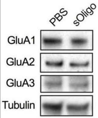 Anti-GluA2/GluR2 Glutamate Receptor Antibody - Image 5