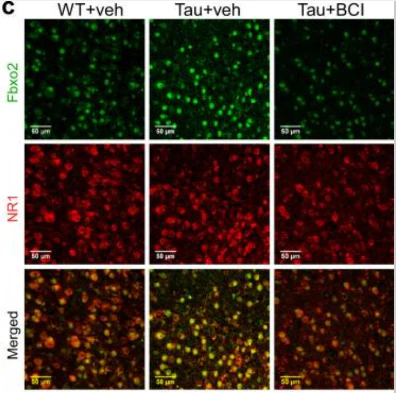 Anti-GluN1/NR1 Glutamate Receptor Antibody - Image 2