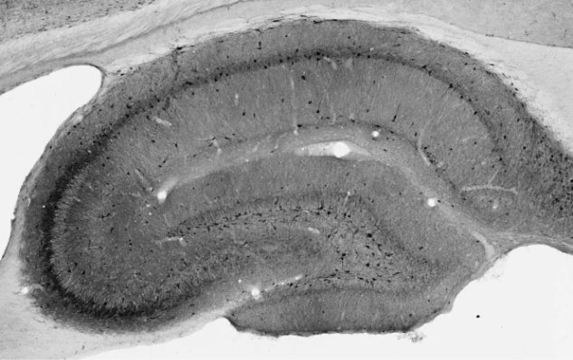 Anti-GluN1/NR1 Glutamate Receptor Antibody - Image 3