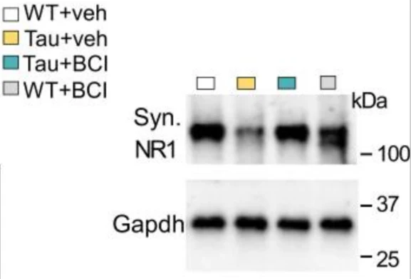 Anti-GluN1/NR1 Glutamate Receptor Antibody - Image 4