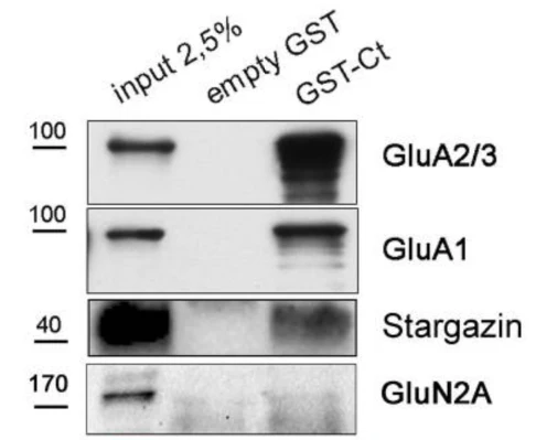 Anti-GluN2A/NR2A Antibody - Image 4