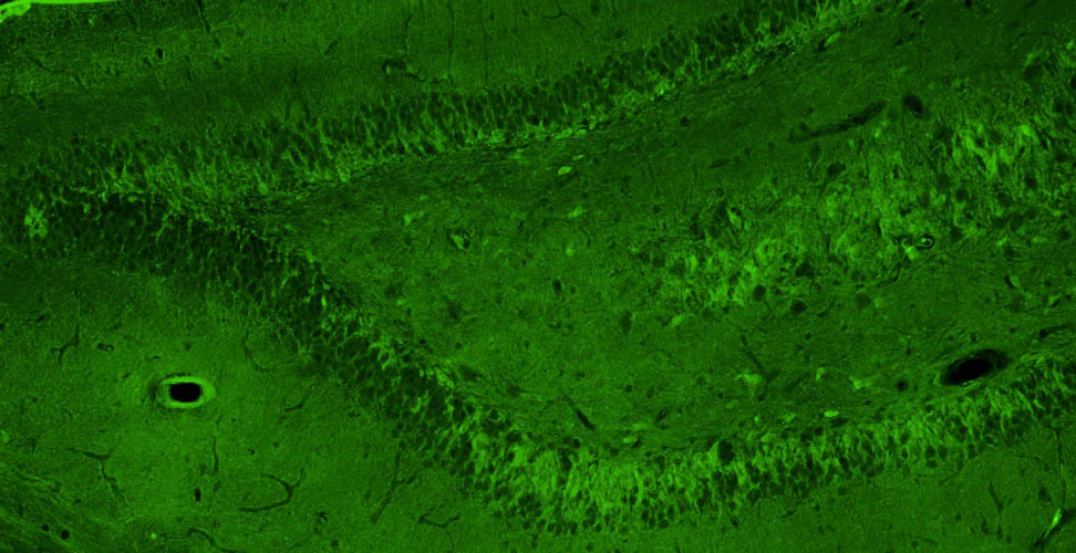 Anti-GluN2A/NR2A Glutamate Receptor Recombinant Chicken Chimeric mAb - Image 3