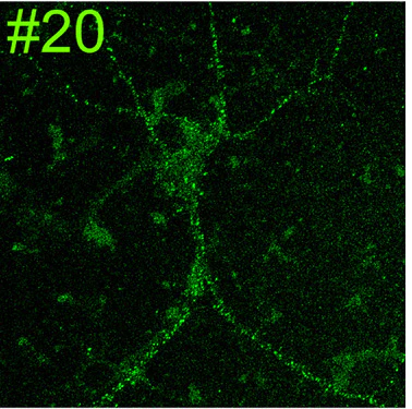 Anti-GluN2B/NR2B Glutamate Receptor Antibody