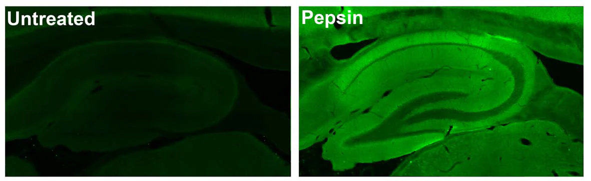 Anti-GluN2B/NR2B Glutamate Receptor Antibody - Image 2