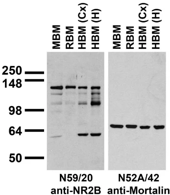 Anti-GluN2B/NR2B Glutamate Receptor Antibody - Image 3