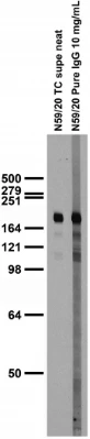 Anti-GluN2B/NR2B Glutamate Receptor Antibody - Image 4
