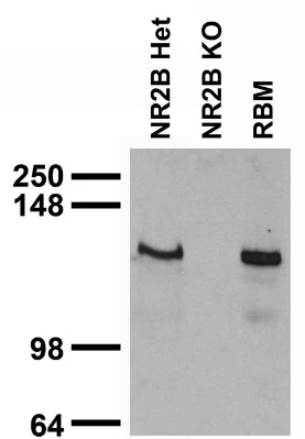 Anti-GluN2B/NR2B Glutamate Receptor Antibody - Image 5