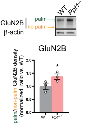 Anti-GluN2B/NR2B Glutamate Receptor Antibody - Image 6