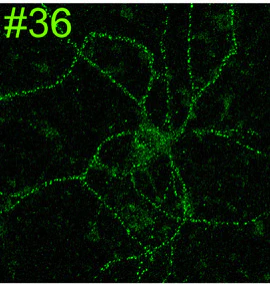 Anti-GluN2B/NR2B Glutamate Receptor Antibody