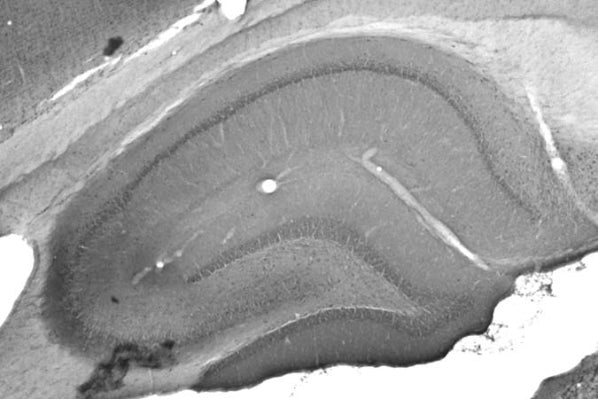 Anti-GluN2B/NR2B Glutamate Receptor Antibody - Image 2