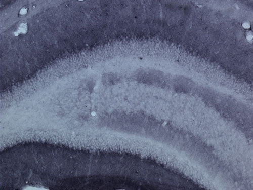 Anti-GluN2B/NR2B Glutamate Receptor Antibody - Image 3