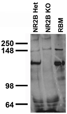Anti-GluN2B/NR2B Glutamate Receptor Antibody - Image 4